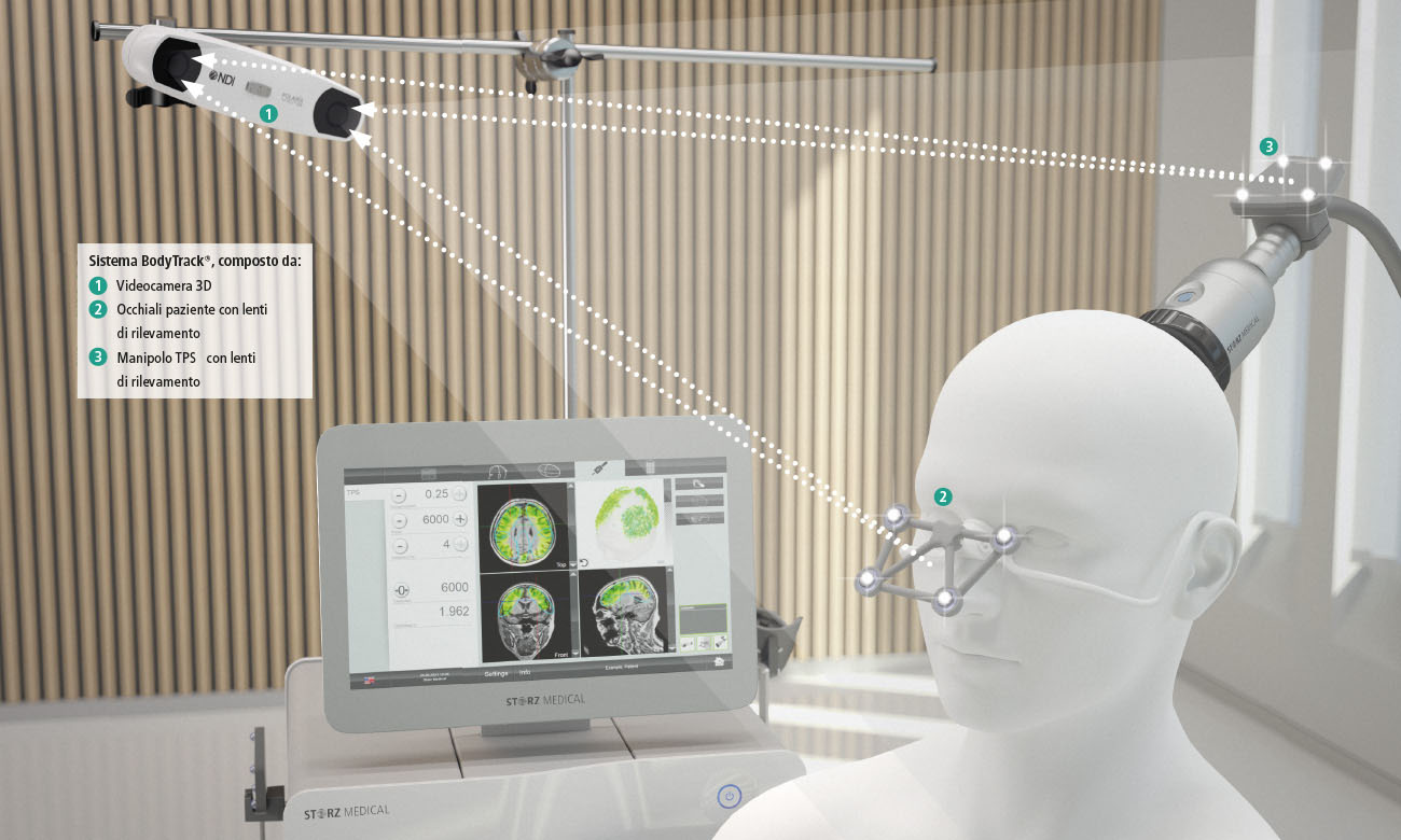 BodyTrack® – Documentazione del trattamento in tempo reale con visualizzazione in 3D